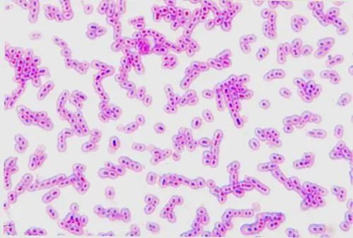 简述肺炎双球菌转化实验过程_肺炎双球菌怎么被世人熟知