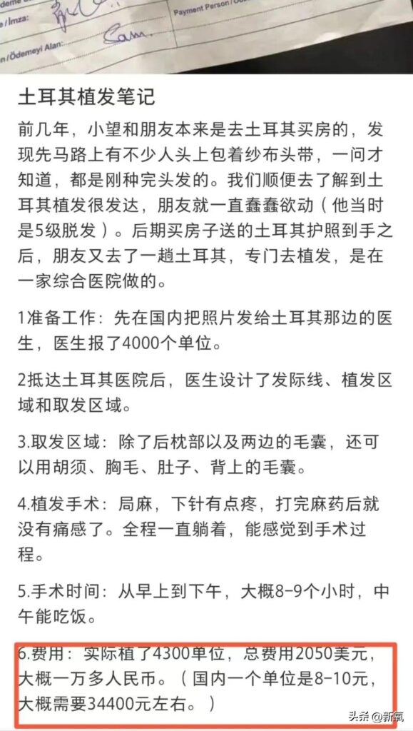 哪里种头发比较好_c罗在马德里开的植发店在哪里