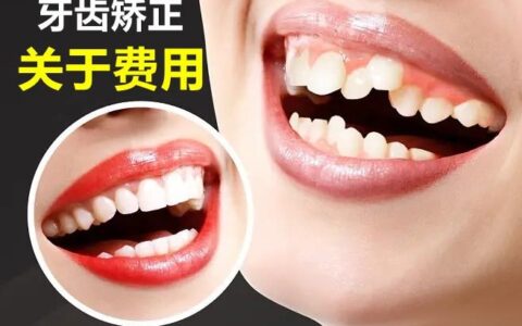 广州矫正牙齿多少钱_影响牙齿矫正的费用