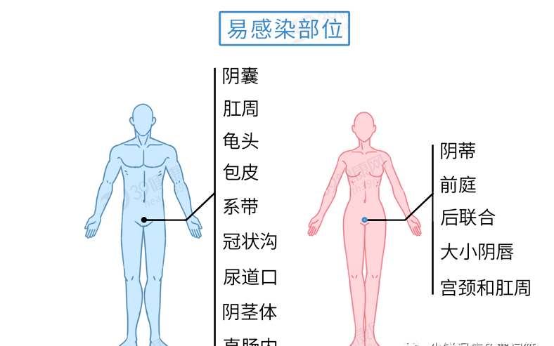 尖湿锐尤典型早期症状什么样，尖锐湿疣有效的治疗方法