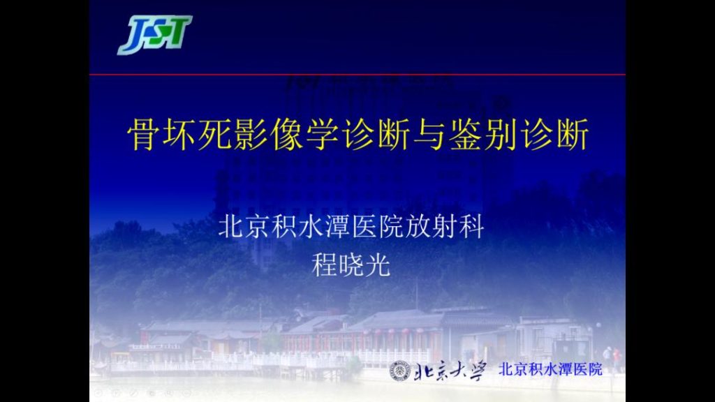治疗股骨头北京哪家医院最好？骨坏死是什么疾病？