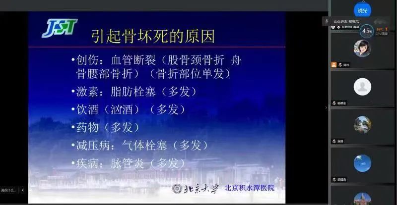 治疗股骨头北京哪家医院最好？骨坏死是什么疾病？