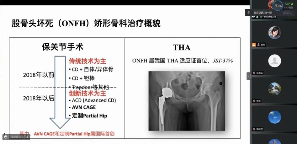 治疗股骨头北京哪家医院最好？骨坏死是什么疾病？