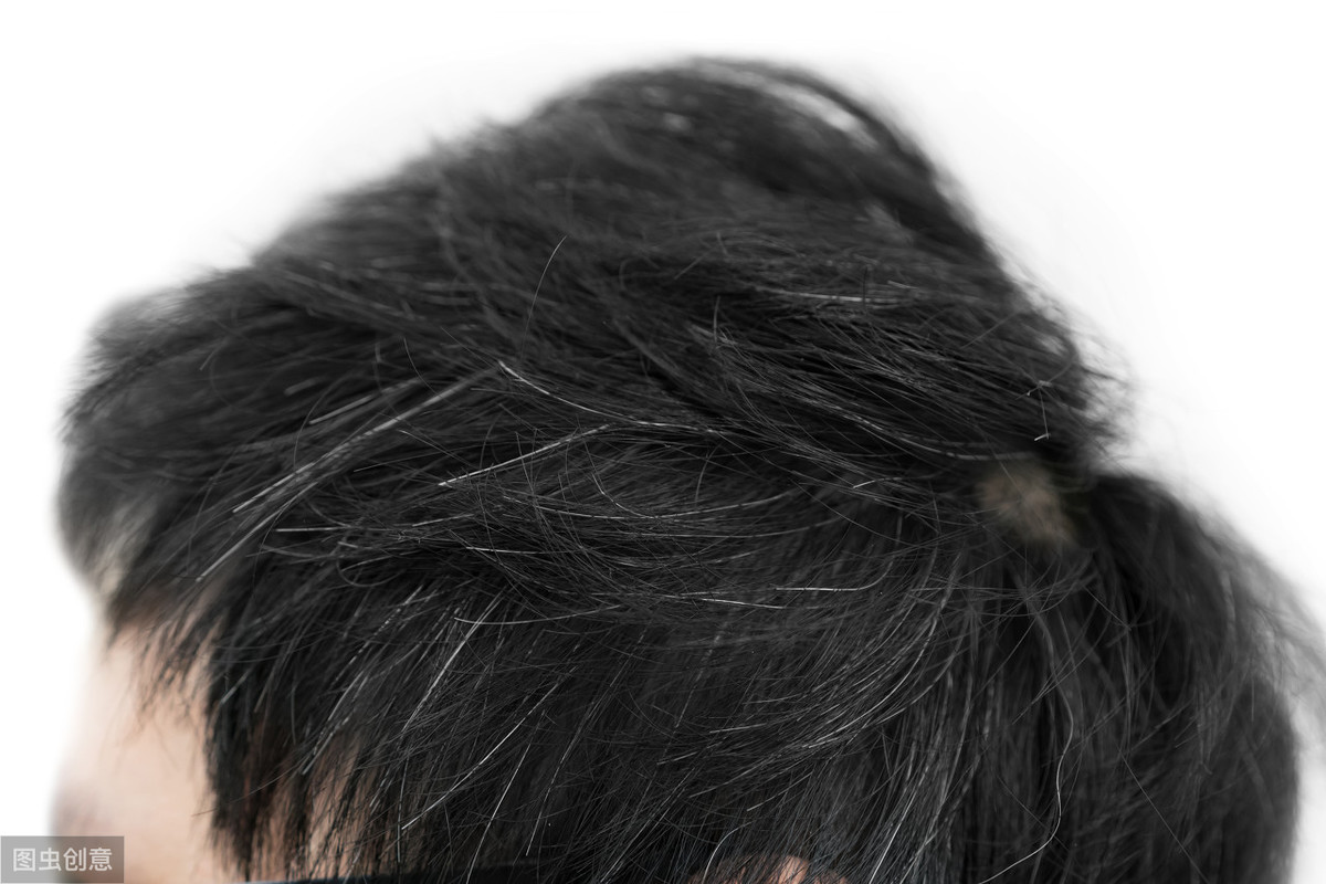 为什么压力大时会长白头发？这些习惯可能会催生白发 - 字节点击