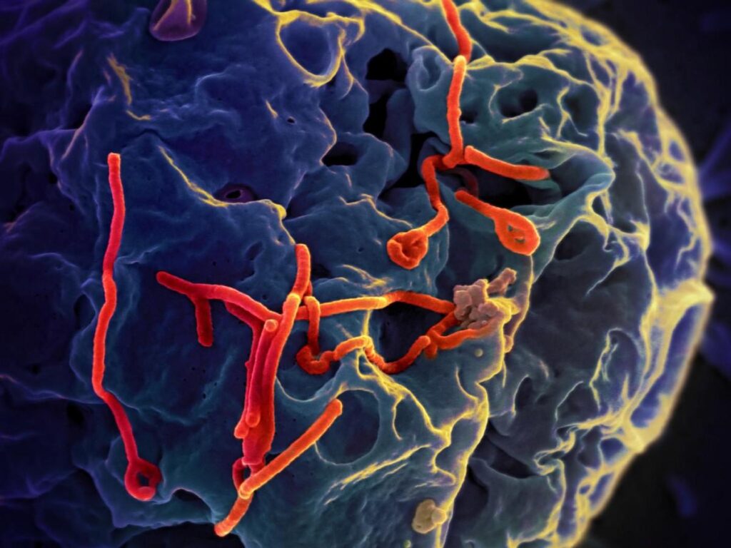 埃博拉病毒复活是什么意思_休眠的埃博拉病毒是如何突然苏醒的